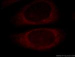 EXD2 Antibody in Immunocytochemistry (ICC/IF)