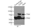 EXD2 Antibody in Immunoprecipitation (IP)