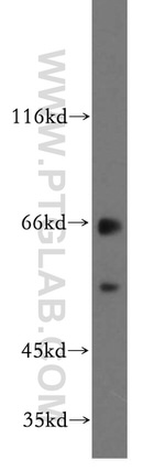 EXD2 Antibody in Western Blot (WB)