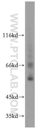 EXD2 Antibody in Western Blot (WB)