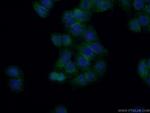 MCT1 Antibody in Immunocytochemistry (ICC/IF)