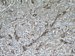 MCT1 Antibody in Immunohistochemistry (Paraffin) (IHC (P))