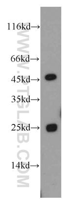 CHST13 Antibody in Western Blot (WB)