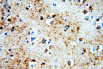 B4GALT6 Antibody in Immunohistochemistry (Paraffin) (IHC (P))