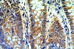 B4GALT6 Antibody in Immunohistochemistry (Paraffin) (IHC (P))