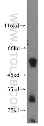 B4GALT6 Antibody in Western Blot (WB)