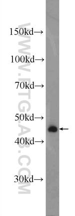 B4GALT6 Antibody in Western Blot (WB)