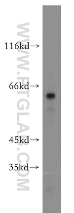 B4GALT6 Antibody in Western Blot (WB)