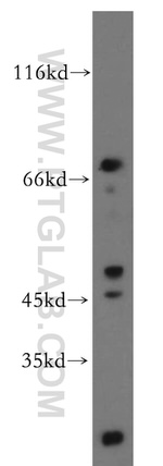 DDX51 Antibody in Western Blot (WB)