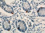 LGR4 Antibody in Immunohistochemistry (Paraffin) (IHC (P))