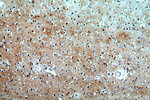 KLHL29 Antibody in Immunohistochemistry (Paraffin) (IHC (P))