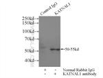 KATNAL1 Antibody in Immunoprecipitation (IP)