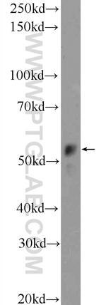 KATNAL1 Antibody in Western Blot (WB)