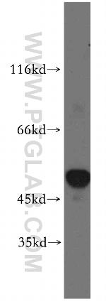 SLC25A23 Antibody in Western Blot (WB)