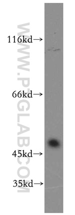 SLC25A23 Antibody in Western Blot (WB)