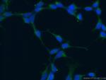 KGA Antibody in Immunocytochemistry (ICC/IF)