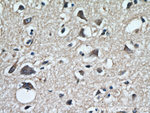 KGA Antibody in Immunohistochemistry (Paraffin) (IHC (P))