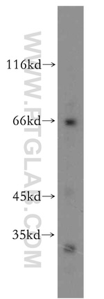 KGA Antibody in Western Blot (WB)