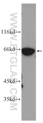 KGA Antibody in Western Blot (WB)