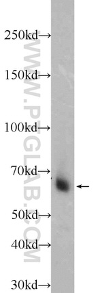 KGA Antibody in Western Blot (WB)