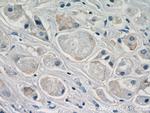 DHRS11 Antibody in Immunohistochemistry (Paraffin) (IHC (P))