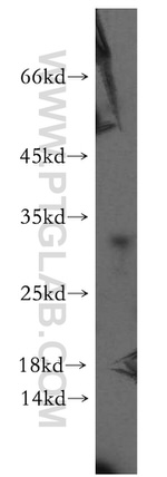 DHRS11 Antibody in Western Blot (WB)