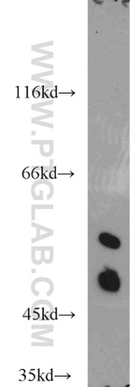 MARK4 Antibody in Western Blot (WB)