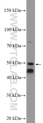 MARK4 Antibody in Western Blot (WB)