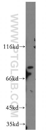 MARK4 Antibody in Western Blot (WB)