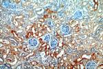 PSAT1 Antibody in Immunohistochemistry (Paraffin) (IHC (P))