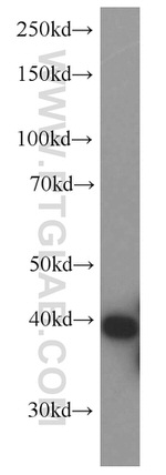 PSAT1 Antibody in Western Blot (WB)