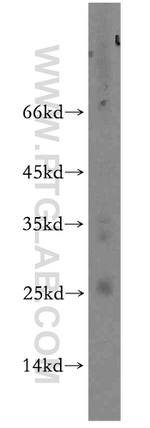 BIN3 Antibody in Western Blot (WB)