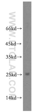 BIN3 Antibody in Western Blot (WB)