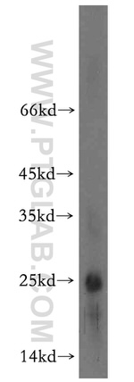 BIN3 Antibody in Western Blot (WB)