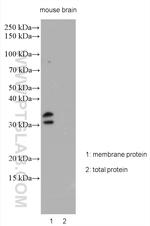 KCNIP2 Antibody in Western Blot (WB)