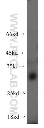 C11orf49 Antibody in Western Blot (WB)