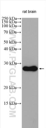 ZNRF2 Antibody in Western Blot (WB)