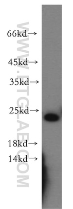 ZNRF2 Antibody in Western Blot (WB)