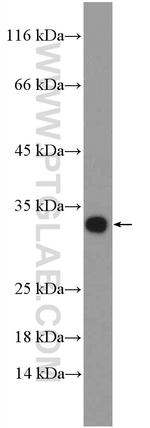 ZNRF2 Antibody in Western Blot (WB)