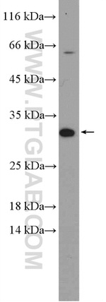 ZNRF2 Antibody in Western Blot (WB)