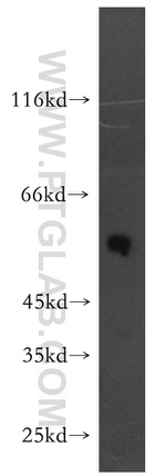 STEAP2 Antibody in Western Blot (WB)