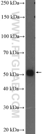 STEAP2 Antibody in Western Blot (WB)