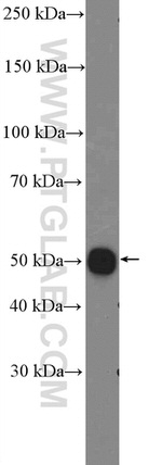 STEAP2 Antibody in Western Blot (WB)