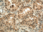 IGF1B Antibody in Immunohistochemistry (Paraffin) (IHC (P))