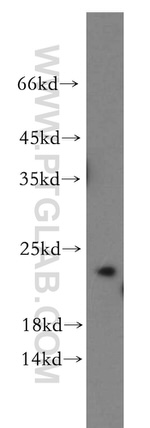 IGF1B Antibody in Western Blot (WB)