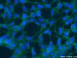 SLIT2 Antibody in Immunocytochemistry (ICC/IF)