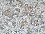 SLIT2 Antibody in Immunohistochemistry (Paraffin) (IHC (P))