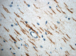 ROBO3 Antibody in Immunohistochemistry (Paraffin) (IHC (P))