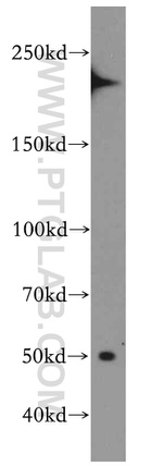 ROBO3 Antibody in Western Blot (WB)