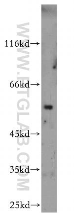 ROBO3 Antibody in Western Blot (WB)